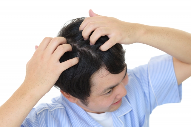 AGA治療（男性型脱毛症）